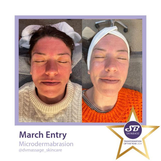 march microdermabrasion dv massage and skincare
