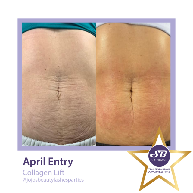 April entries - jojos beauty - before and after collagen lift